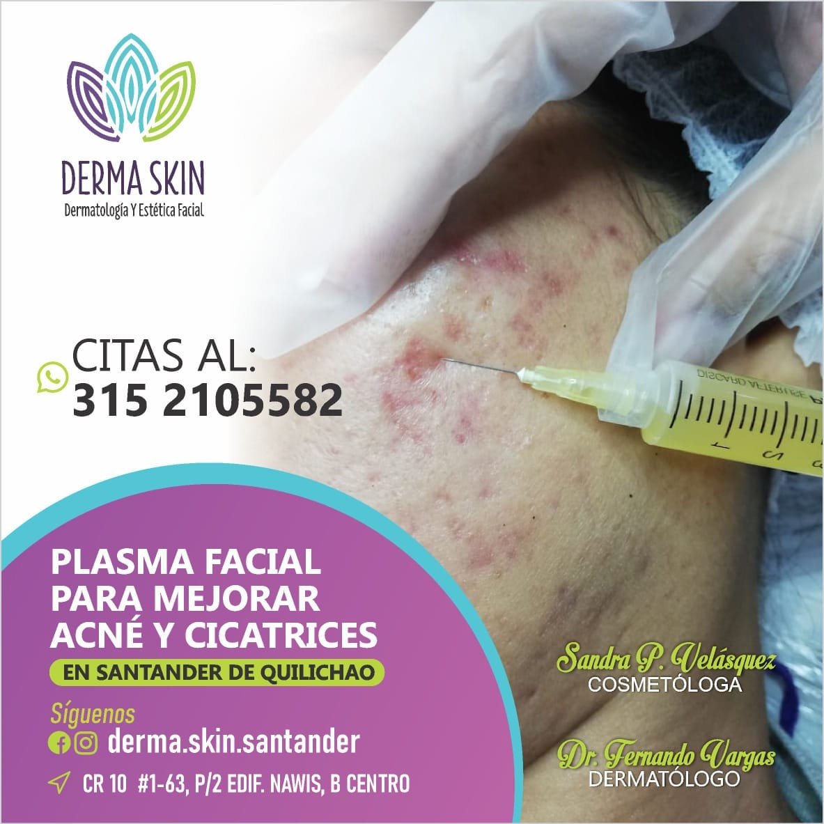 TIENES PROBLEMAS DE ACNÉ2